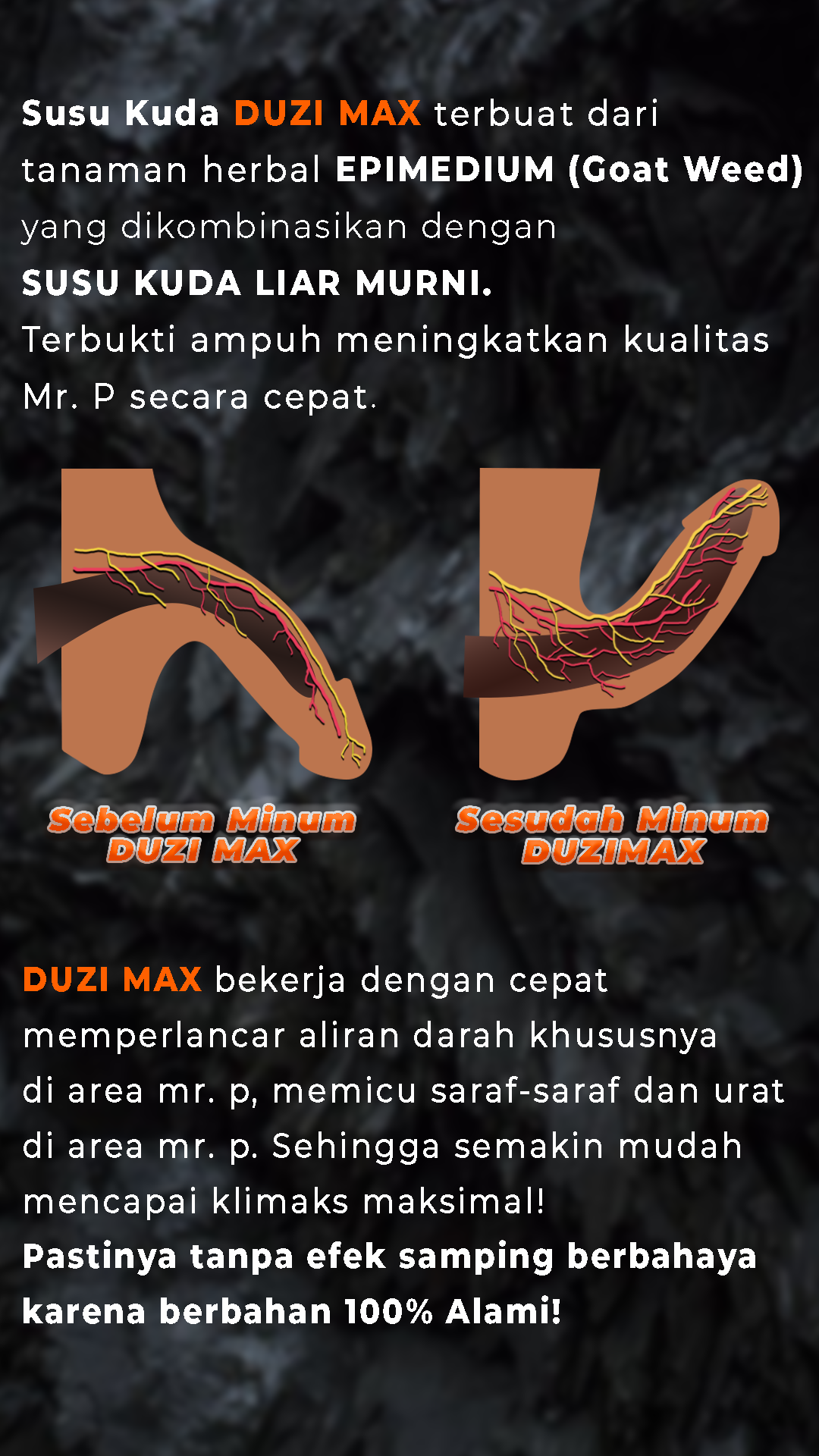 3 DZM